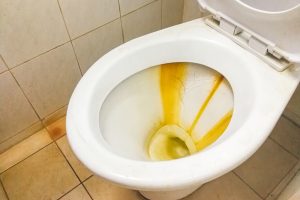 Receptura našich prarodičů: Na likvidaci vodního kamene v záchodové míse stačí horký ocet s jedlou sodou