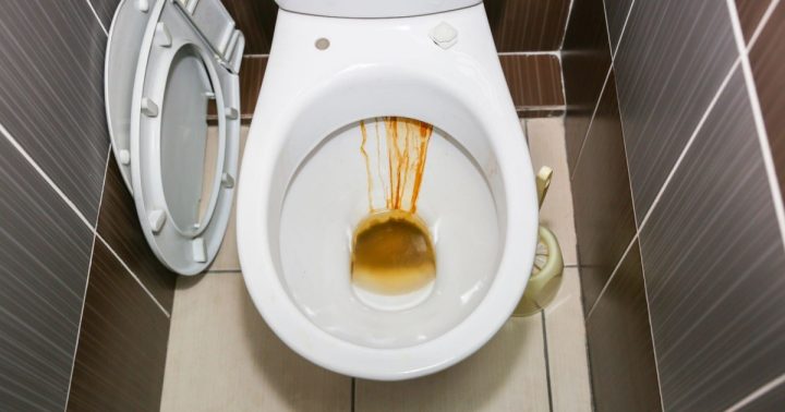 rezavy vodni kamen zachod