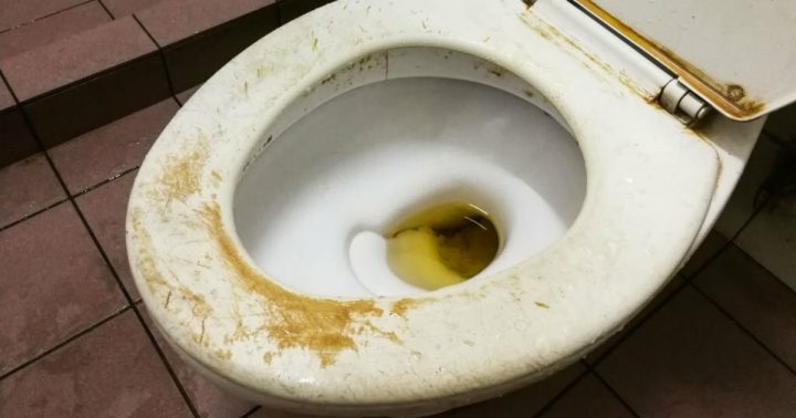 zlute skvrny zachodove prkenko misa