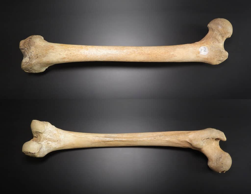 femur anterior posterior