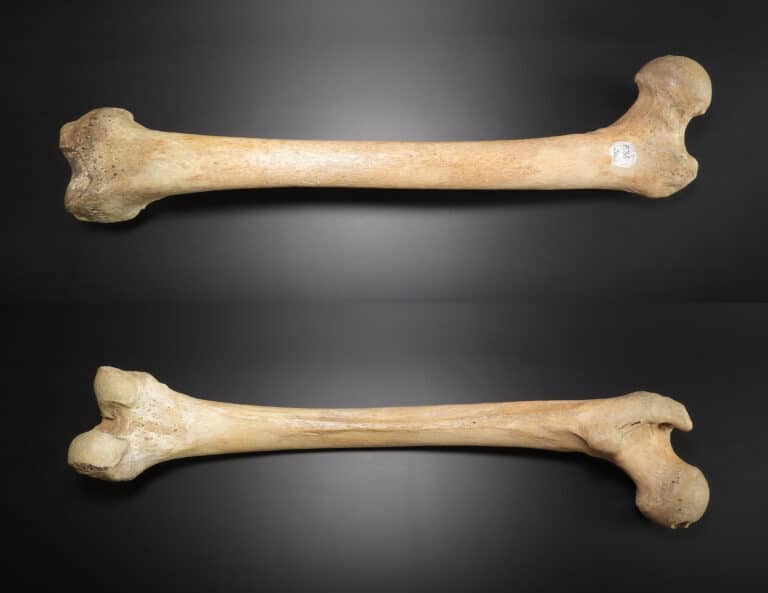 femur anterior posterior